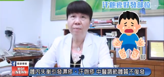 聖元中醫治療濕疹和汗皰疹