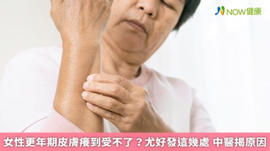 ▲聖元中醫診所院長鄭愛蓮醫師表示，很多婦女在更年期時會覺得皮膚癢，甚至身上還會長出小片紅疹，位置大多在背、前胸或手腳。（圖／NOW健康製作；圖片來源／ingimage）
